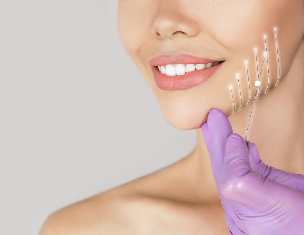 threadlift-procedure-and-other-procedures